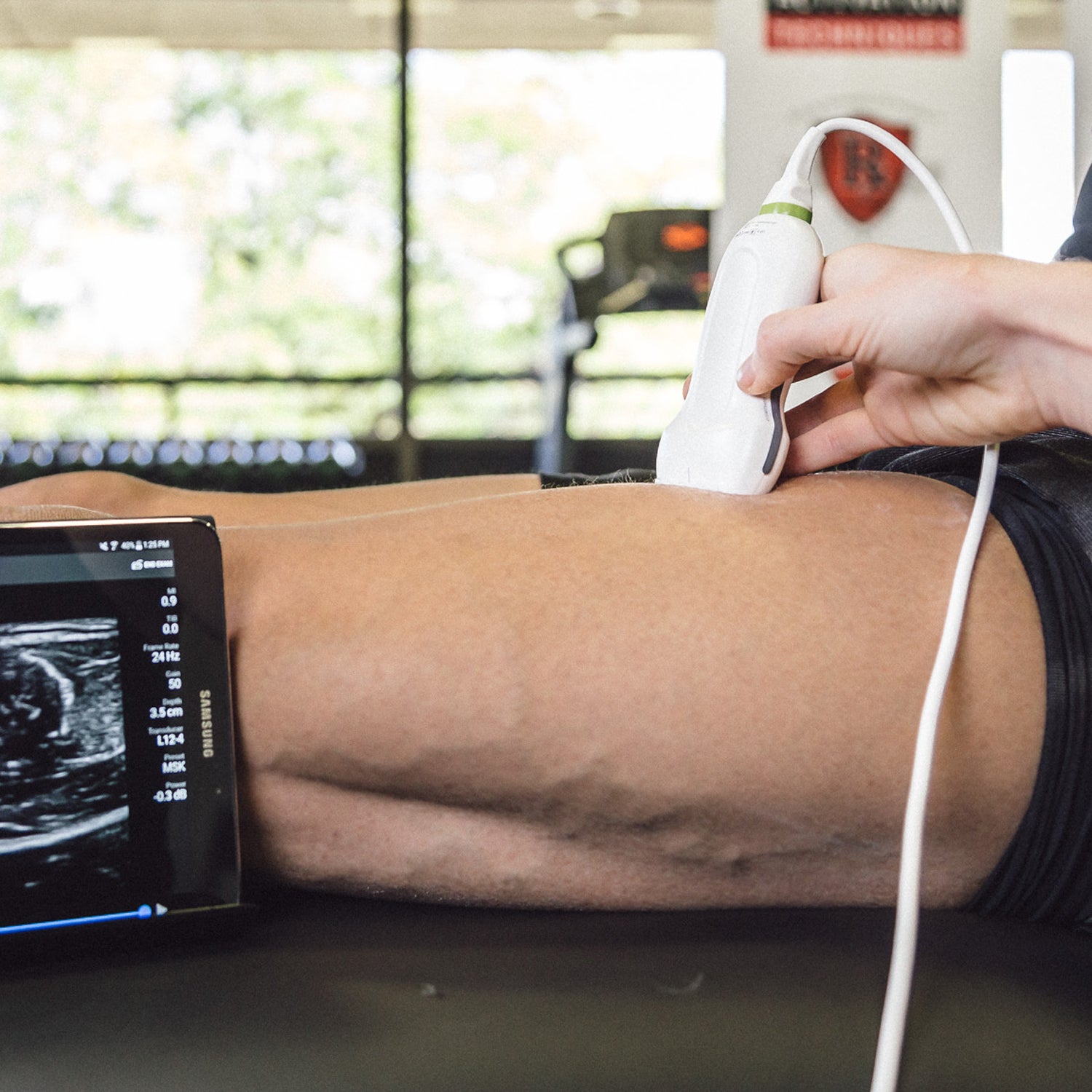 Hardware and process of MuscleSound imaging.