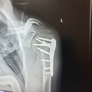 Andrew Bernstein’s repaired humorous