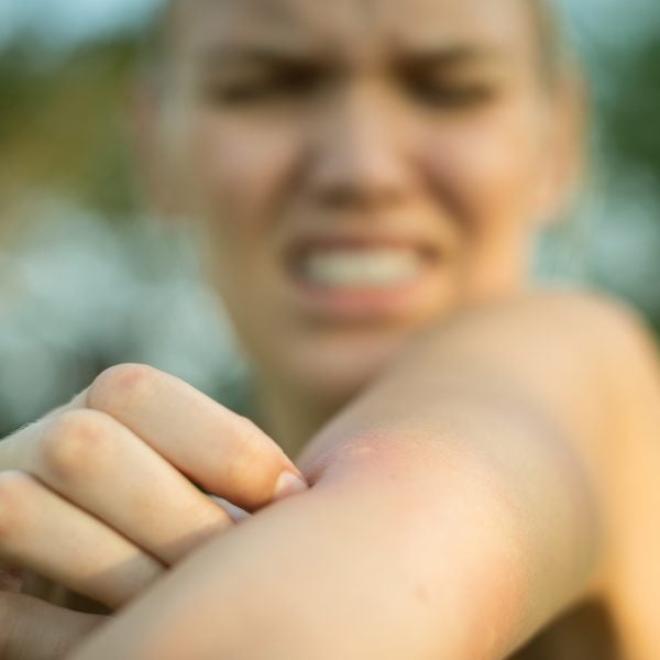After decades doubling as a human blood buffet and trying every remedy under the sun to prevent bites and treat them, it seemed too good to be true.