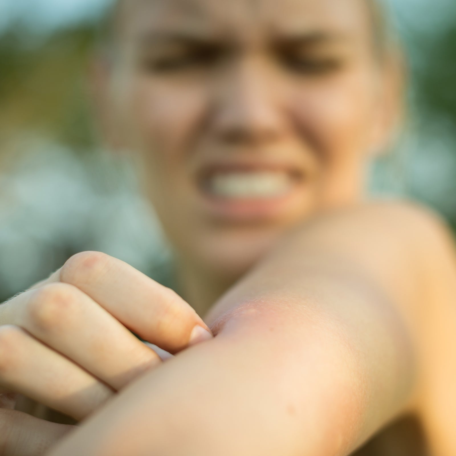 After decades doubling as a human blood buffet and trying every remedy under the sun to prevent bites and treat them, it seemed too good to be true.