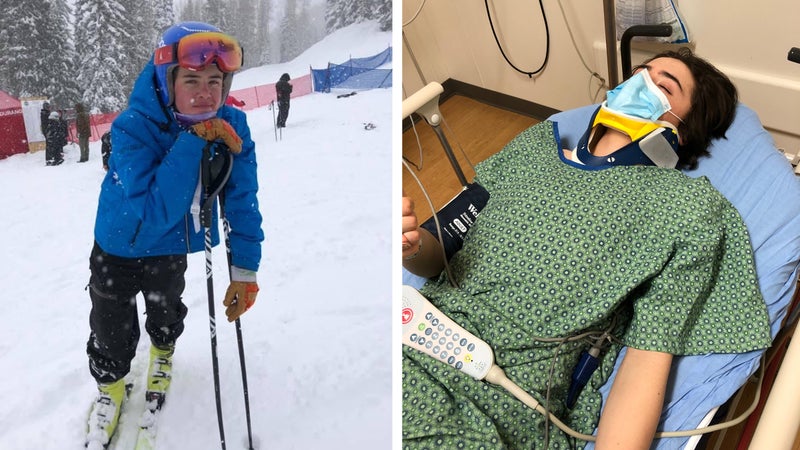 Left: Hatcher at a junior ski racing competition in Colorado. In the emergency room after his fall.