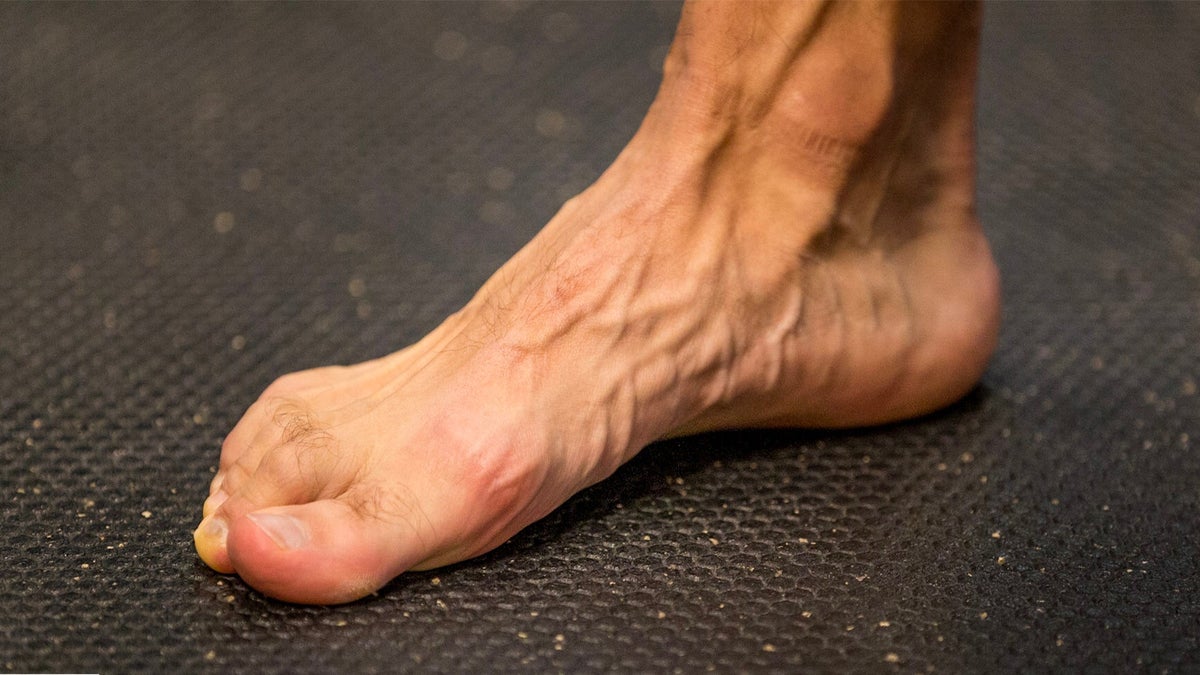 Are Stronger Feet the Key to InjuryFree Running? Outside Online