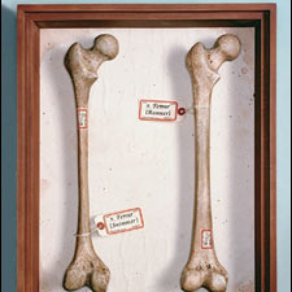 strong bones