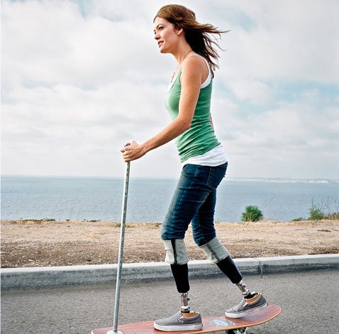 Amy Purdy