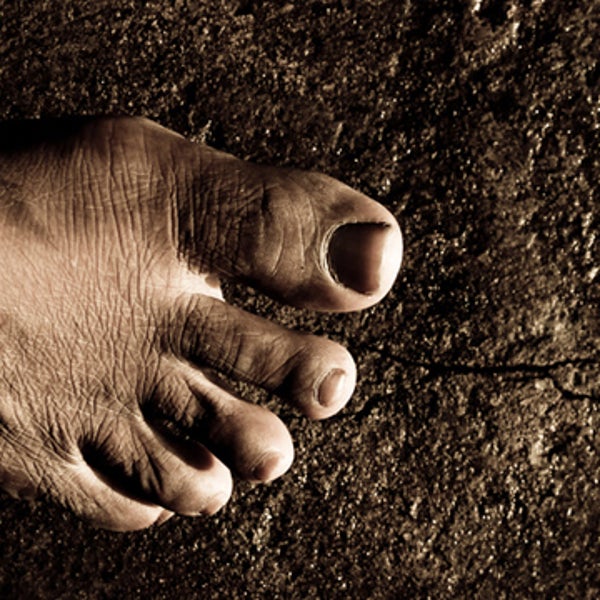 Plantar Fasciitis cure foot feet pain how to