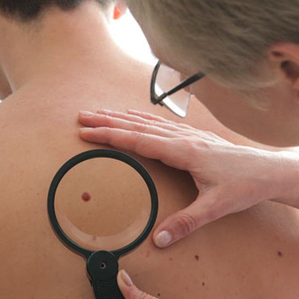 outside fitness coach skin cancer skin care