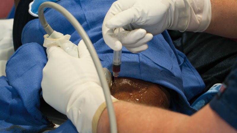 stem cells knee